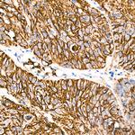 GLUT1 Antibody in Immunohistochemistry (Paraffin) (IHC (P))