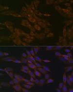 TIMM50 Antibody in Immunocytochemistry (ICC/IF)