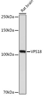 VPS18 Antibody in Western Blot (WB)