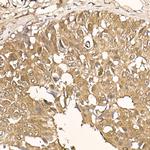 AKT1 Antibody in Immunohistochemistry (Paraffin) (IHC (P))