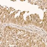 AKT1 Antibody in Immunohistochemistry (Paraffin) (IHC (P))