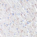 N-cadherin Antibody in Immunohistochemistry (Paraffin) (IHC (P))