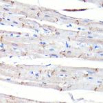 N-cadherin Antibody in Immunohistochemistry (Paraffin) (IHC (P))