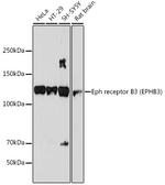 EphB3 Antibody in Western Blot (WB)