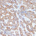 HMGCS2 Antibody in Immunohistochemistry (Paraffin) (IHC (P))