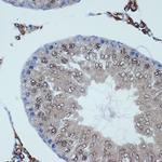 RANBP9 Antibody in Immunohistochemistry (Paraffin) (IHC (P))