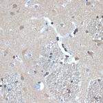 RANBP9 Antibody in Immunohistochemistry (Paraffin) (IHC (P))