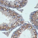 CHMP2B Antibody in Immunohistochemistry (Paraffin) (IHC (P))