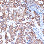 GOT2 Antibody in Immunohistochemistry (Paraffin) (IHC (P))