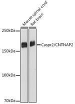 Caspr2 Antibody in Western Blot (WB)