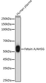 Fetuin A Antibody in Western Blot (WB)