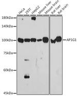 gamma Adaptin Antibody in Western Blot (WB)