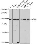 ATRIP Antibody in Western Blot (WB)