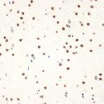 NAT10 Antibody in Immunohistochemistry (Paraffin) (IHC (P))