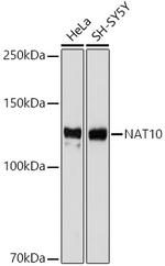 NAT10 Antibody in Western Blot (WB)