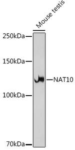 NAT10 Antibody in Western Blot (WB)