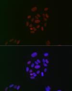 CIRBP Antibody in Immunocytochemistry (ICC/IF)