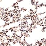 CIRBP Antibody in Immunohistochemistry (Paraffin) (IHC (P))