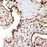 CIRBP Antibody in Immunohistochemistry (Paraffin) (IHC (P))