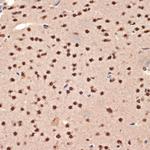 CIRBP Antibody in Immunohistochemistry (Paraffin) (IHC (P))