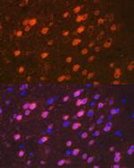 TBR1 Antibody in Immunocytochemistry (ICC/IF)