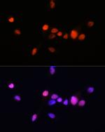 Androgen Receptor Antibody in Immunocytochemistry (ICC/IF)