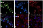 Androgen Receptor Antibody in Immunocytochemistry (ICC/IF)