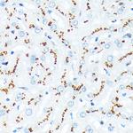 TGN46 Antibody in Immunohistochemistry (Paraffin) (IHC (P))