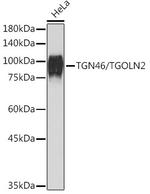 TGN46 Antibody in Western Blot (WB)