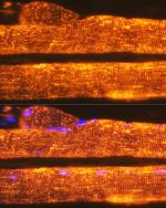 Calsequestrin Antibody in Immunohistochemistry (Paraffin) (IHC (P))