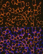 CDH16 Antibody in Immunocytochemistry (ICC/IF)