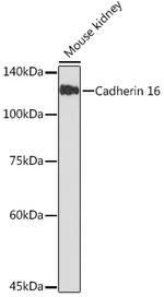 CDH16 Antibody in Western Blot (WB)