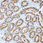 CYP4A11/CYP4A22 Antibody in Immunohistochemistry (Paraffin) (IHC (P))