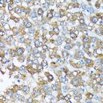 CYP4A11/CYP4A22 Antibody in Immunohistochemistry (Paraffin) (IHC (P))