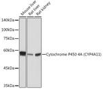 CYP4A11/CYP4A22 Antibody in Western Blot (WB)