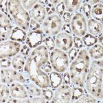 Ubiquitin Antibody in Immunohistochemistry (Paraffin) (IHC (P))