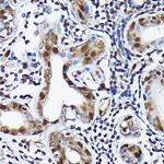 Ubiquitin Antibody in Immunohistochemistry (Paraffin) (IHC (P))