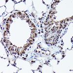 Ubiquitin Antibody in Immunohistochemistry (Paraffin) (IHC (P))