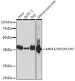 HB9 Antibody in Western Blot (WB)