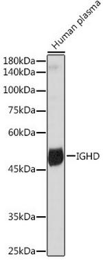 Human IgD Antibody in Western Blot (WB)