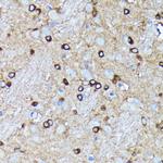 AGO2 Antibody in Immunohistochemistry (Paraffin) (IHC (P))