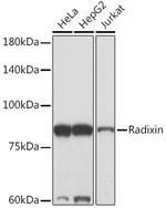 Radixin Antibody in Western Blot (WB)