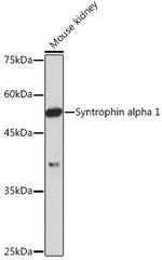 Syntrophin alpha-1 Antibody in Western Blot (WB)