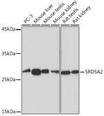 SRD5A2 Antibody in Western Blot (WB)