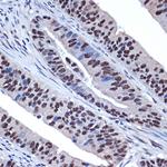 WDR4 Antibody in Immunohistochemistry (Paraffin) (IHC (P))