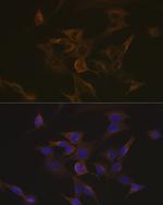 MAPRE3 Antibody in Immunocytochemistry (ICC/IF)