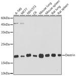 Destrin Antibody in Western Blot (WB)