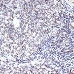 UNC84B Antibody in Immunohistochemistry (Paraffin) (IHC (P))