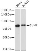 UNC84B Antibody in Western Blot (WB)