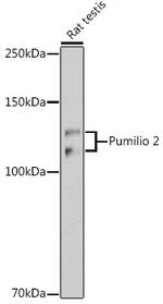 PUM2 Antibody in Western Blot (WB)